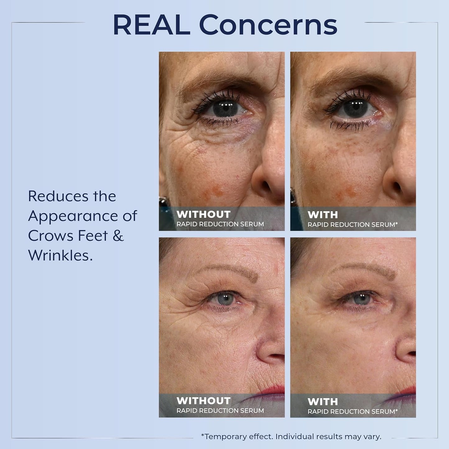 Plexaderm Rapid Reduction Serum