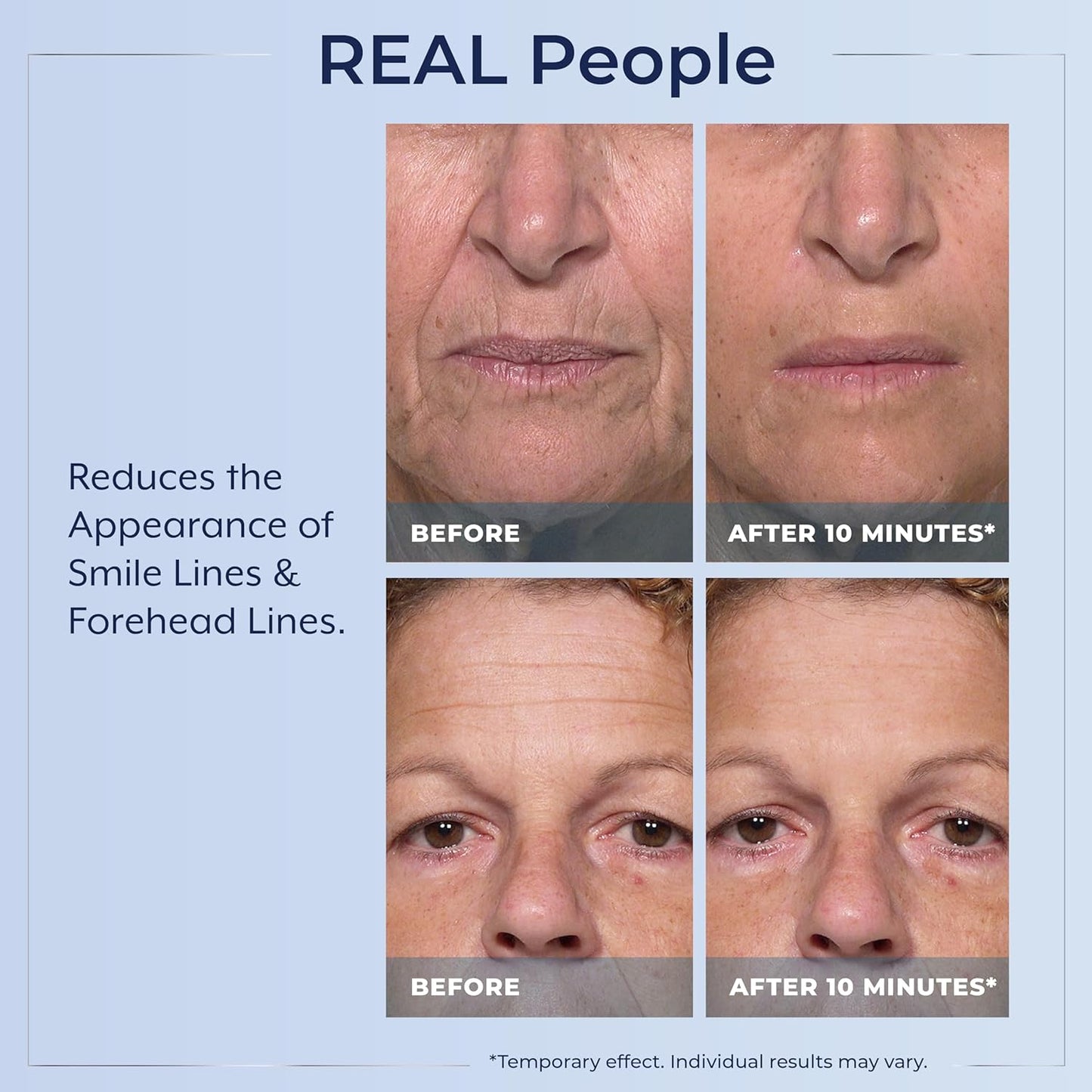 Plexaderm Rapid Reduction Serum