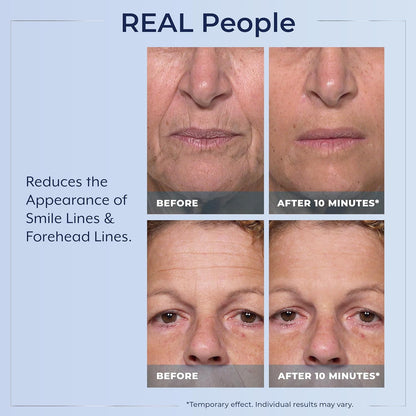 Plexaderm Rapid Reduction Serum