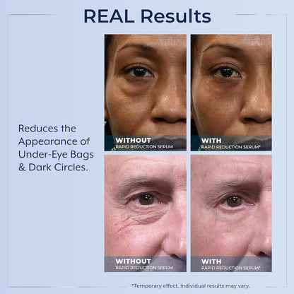 Plexaderm Rapid Reduction Serum